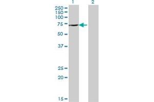 Western Blot analysis of DDX43 expression in transfected 293T cell line by DDX43 monoclonal antibody (M07), clone 3G12.