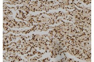 ABIN6276450 at 1/100 staining Human lung tissue by IHC-P. (NCK1 anticorps  (Internal Region))
