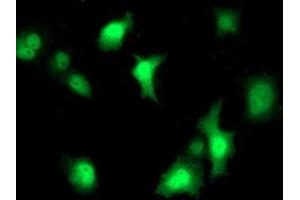 Image no. 4 for anti-Signal Transducer and Activator of Transcription 4 (STAT4) antibody (ABIN1501174)