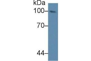 Western blot analysis of Mouse Serum, using Mouse NUP98 Antibody (1 µg/ml) and HRP-conjugated Goat Anti-Rabbit antibody (
