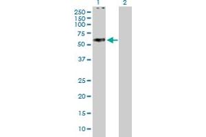 Western Blot analysis of ABCC11 expression in transfected 293T cell line by ABCC11 MaxPab polyclonal antibody. (ABCC11 anticorps  (AA 1-553))