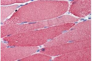 Human Skeletal Muscle (formalin-fixed, paraffin-embedded) stained with  antibody ABIN462270 followed by biotinylated secondary antibody, alkaline phosphatase-streptavidin and chromogen.