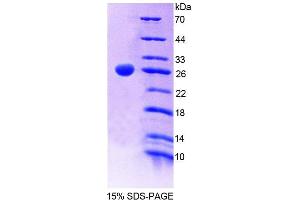 SDS-PAGE analysis of Human MYH11 Protein.