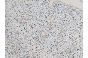 ABIN6267244 at 1/100 staining rat uterine tissue sections by IHC-P.