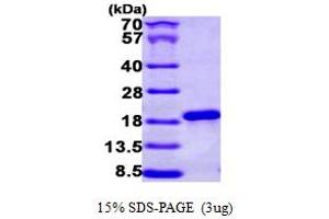 SDS-PAGE (SDS) image for Nuclear Cap Binding Protein Subunit 2 (NCBP2) (AA 1-156) protein (His tag) (ABIN667237)