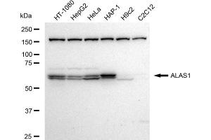 Western blotting analysis using ALAS1 antibody (ABIN7797590).