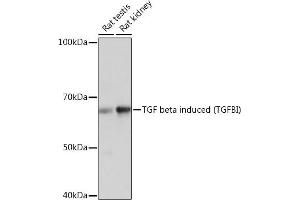 Western blot analysis of extracts of various cell lines, using TGF beta induced TGF beta induced (TGFBI) Rabbit mAb (ABIN7270915) at 1:1000 dilution. (TGFBI anticorps)