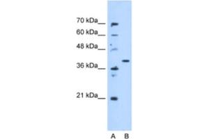Western Blotting (WB) image for anti-Enoyl CoA Hydratase Domain Containing 3 (ECHDC3) antibody (ABIN2463233) (ECHDC3 anticorps)