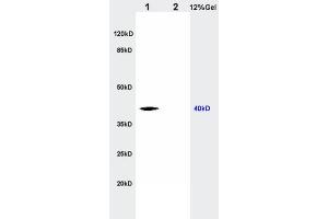 L1 rat kidney lysates L2 rat brain lysates probed with Anti CTHRC1 Polyclonal Antibody, Unconjugated  at 1:200 in 4˚C. (CTHRC1 anticorps  (AA 31-130))