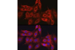 Immunofluorescence analysis of PC-12 cells using OL Rabbit pAb (1671) at dilution of 1:150 (40x lens). (OLA1 anticorps  (AA 297-396))
