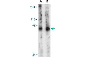 Western blot analysis of SLITRK6 in mouse lung tissue lysate with SLITRK6 polyclonal antibody  at (A) 0.