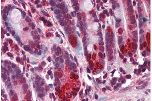 Human Small Intestine (formalin-fixed, paraffin-embedded) stained with NOD2 antibody ABIN351443 at 3 ug/ml followed by biotinylated goat anti-rabbit IgG secondary antibody ABIN481713, alkaline phosphatase-streptavidin and chromogen. (NOD2 anticorps  (N-Term))