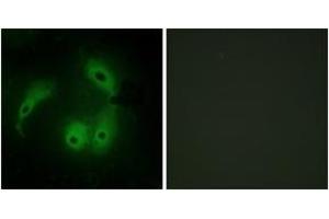 Immunofluorescence analysis of HeLa cells, using AKAP14 Antibody. (AKAP14 anticorps  (AA 1-50))
