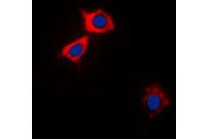 Immunofluorescent analysis of CaMK2 alpha/delta staining in HEK293A cells. (CaMK2 alpha/delta anticorps  (Center))