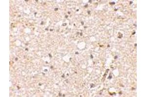 Immunohistochemical staining of human brain tissue using AP30381PU-N Grik1 antibody at 2. (GRIK1 anticorps  (Center))