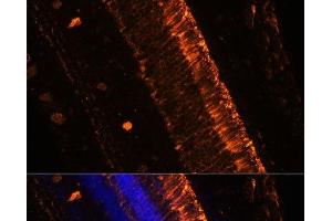 Immunofluorescence analysis of Mouse eye using KCNS2 Polyclonal Antibody at dilution of 1:100 (20x lens).