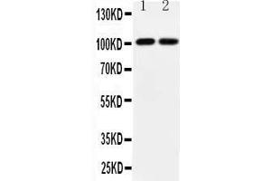 Anti-GRIA3 antibody, All Western blottingAll lanes: Anti-GRIA3  at 0.