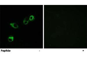 Immunofluorescence analysis of MCF-7 cells, using CCRL1 polyclonal antibody . (CCRL1 anticorps  (C-Term))