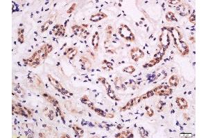 Formalin-fixed and paraffin embedded human kidney tissue labeled with Anti-CD18 (Thr758) Polyclonal Antibody, Unconjugated  at 1:200 followed by conjugation to the secondary antibody and DAB staining.