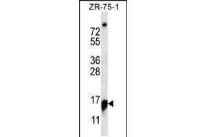 Western blot analysis in ZR-75-1 cell line lysates (35ug/lane). (RPP25 anticorps  (C-Term))