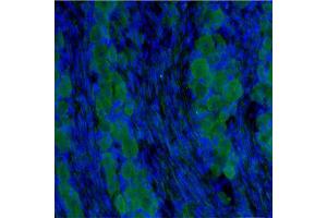 IF on rat DRG (postnatal day 7) at 40 µg/ml concentration using Sheep antibody to extracellular domain of TrkC (Trk-C, NTRK3, NT-3 growth factor receptor): IgG (ABIN351085), DAPI counterstained.