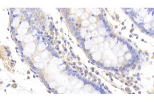 Detection of Slit2 in Human Colon Tissue using Polyclonal Antibody to Slit Homolog 2 (Slit2)