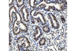 IHC analysis of Ubc13/UBE2N using anti-Ubc13/UBE2N antibody (ABIN7599924).