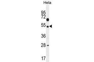 TSPYL6 Antibody (Center) western blot analysis in Hela cell line lysates (35 µg/lane). (TSPY-Like 6 anticorps  (Middle Region))
