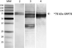 Western Blot analysis of Human, Mouse, Rat NIH3T3, Rat Brain, and HEK-293 cell lysates showing detection of ~78 kDa GRP78 protein using Mouse Anti-GRP78 Monoclonal Antibody, Clone 3C5-1A4 . (GRP78 anticorps)