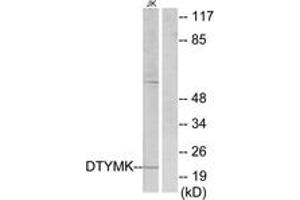 Western Blotting (WB) image for anti-Deoxythymidylate Kinase (Thymidylate Kinase) (DTYMK) (AA 1-50) antibody (ABIN2889430) (DTYMK anticorps  (AA 1-50))