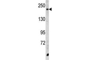 Western blot analysis of CPD antibody and HeLa lysate. (CPD anticorps  (AA 1019-1048))
