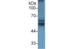 Detection of BACE2 in Rat Spleen lysate using Polyclonal Antibody to Beta Secretase 2 (BACE2) (BACE2 anticorps  (AA 242-502))