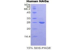 SDS-PAGE (SDS) image for N-Acetylgalactosaminidase, alpha (NAGA) (AA 18-217) protein (His tag) (ABIN2121733) (NAGA Protein (AA 18-217) (His tag))