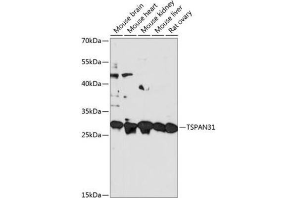 TSPAN31 antibody  (AA 95-175)