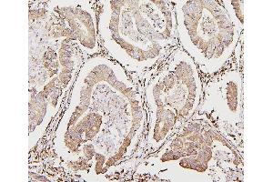IHC analysis of CALR using anti-CALR antibody (ABIN7600329). (Calreticulin anticorps  (AA 18-323))