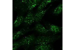 Immunofluorescence (IF) image for anti-Sorting Nexin 1 (SNX1) antibody (ABIN5877304) (Sorting Nexin 1 anticorps)