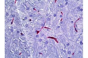 Anti-RECA-1 antibody IHC of rat brain, cerebellum vessels. (RECA-1 anticorps)