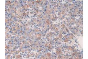 IHC-P analysis of Human Pancreas Tissue, with DAB staining. (Kallikrein 6 anticorps  (AA 17-244))