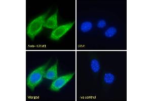 ABIN5539625 Immunofluorescence analysis of paraformaldehyde fixed NIH3T3 cells, permeabilized with 0. (ICAM1 anticorps  (Internal Region))