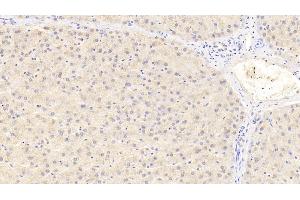 Detection of PCNT in Human Liver Tissue using Polyclonal Antibody to Pericentrin (PCNT) (PCNT anticorps  (AA 2987-3246))