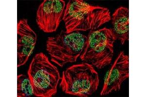 Fluorescent confocal image of U251 cell stained with TBP antibody at 1:25. (TBP anticorps  (AA 210-239))