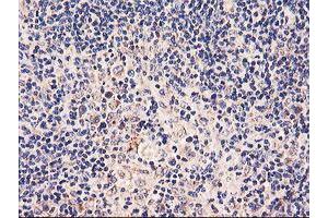 Image no. 7 for anti-Prenyl (Decaprenyl) Diphosphate Synthase, Subunit 2 (PDSS2) antibody (ABIN1500138)