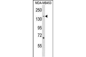 Western blot analysis in MDA-MB453 cell line lysates (35ug/lane). (ARHGEF11 anticorps  (AA 605-632))