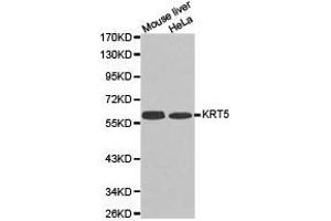 Western Blotting (WB) image for anti-Keratin 5 (KRT5) antibody (ABIN1873489) (Cytokeratin 5 anticorps)