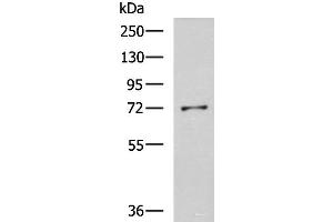 Western blot analysis of K562 cell lysate using GSTCD Polyclonal Antibody at dilution of 1:800 (GSTCD anticorps)