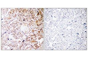 Immunohistochemistry analysis of paraffin-embedded human placenta tissue, using CCDC102B antibody. (CCDC102B anticorps  (Internal Region))