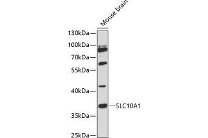 Western blot analysis of extracts of mouse brain, using SLC10 antibody (2721) at 1:3000 dilution. (SLC10A1 anticorps  (C-Term))
