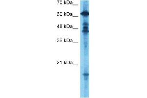 Host:  Rabbit  Target Name:  GCYB1  Sample Type:  Fetal Brain lysates  Antibody Dilution:  0.