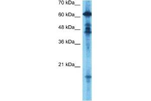 Host:  Rabbit  Target Name:  GCYB1  Sample Type:  Fetal Brain lysates  Antibody Dilution:  0. (GUCY1B3 anticorps  (N-Term))
