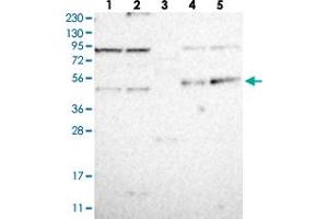 Western blot analysis of Lane 1: RT-4, Lane 2: U-251 MG, Lane 3: Human Plasma, Lane 4: Liver, Lane 5: Tonsil with CDCP2 polyclonal antibody .
